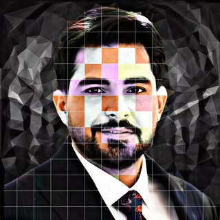 جراح بینی تبریز | دکتر گل محمدی