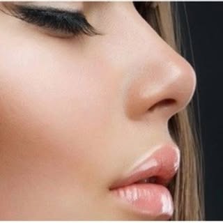 جراح بینی کرج