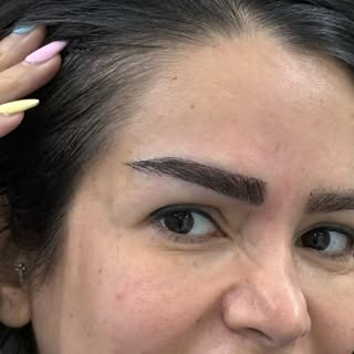 کاشت مو/کاشت ابرو/کاشت ریش