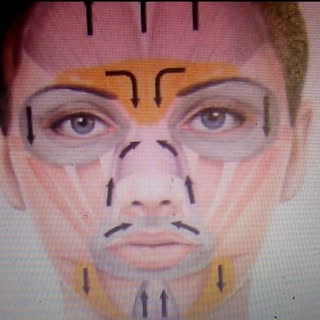 Botox-دکتر گلستان