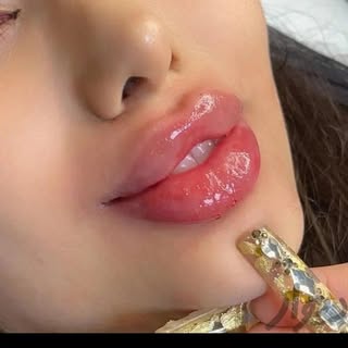 ژل فیلر بوتاکس لیزر هایفو فیشیال