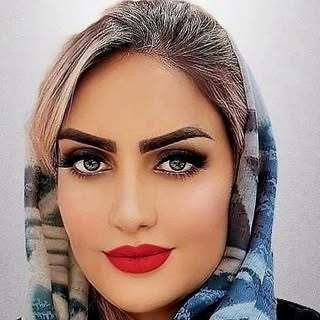 •فیلر|بوتاکس|هایفو|آراف|اصفهان.
