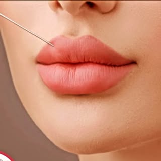 ژل و بوتاکس قم