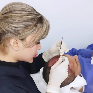 کاشت مو/ کاشت ابرو/کاشت ریش و سیبیل/ مجموعه کلینیک اهواز نوین