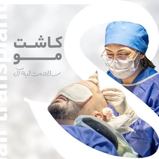کاشت مو ایلام/کاشتمو /کاشت ابرو