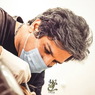 کلینیک کاشت مو| کاشت ابروی لاوین|کاشت مو رشت دیلمان