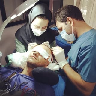 کاشت مو تبریز