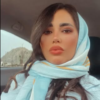 کراتین مو_کرج