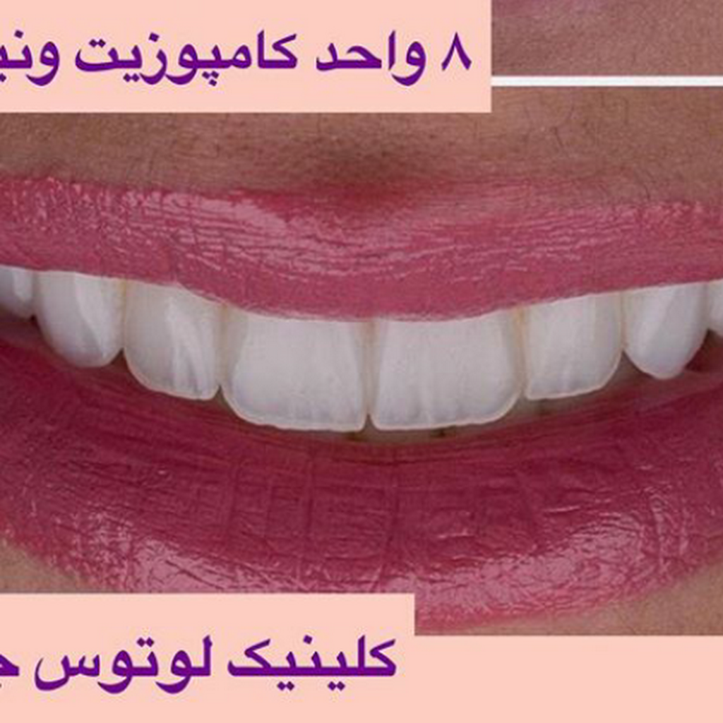 کلینیک لوتوس - پوست، لیزر، زیبایی و دندانپزشکی