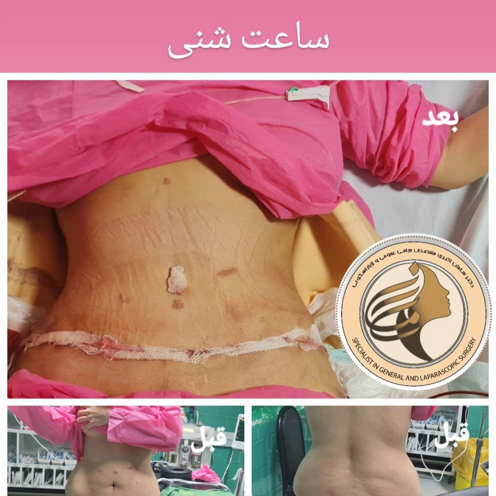 مطب دکتر سامان اکبری متخصص جراحی عمومی زیبایی