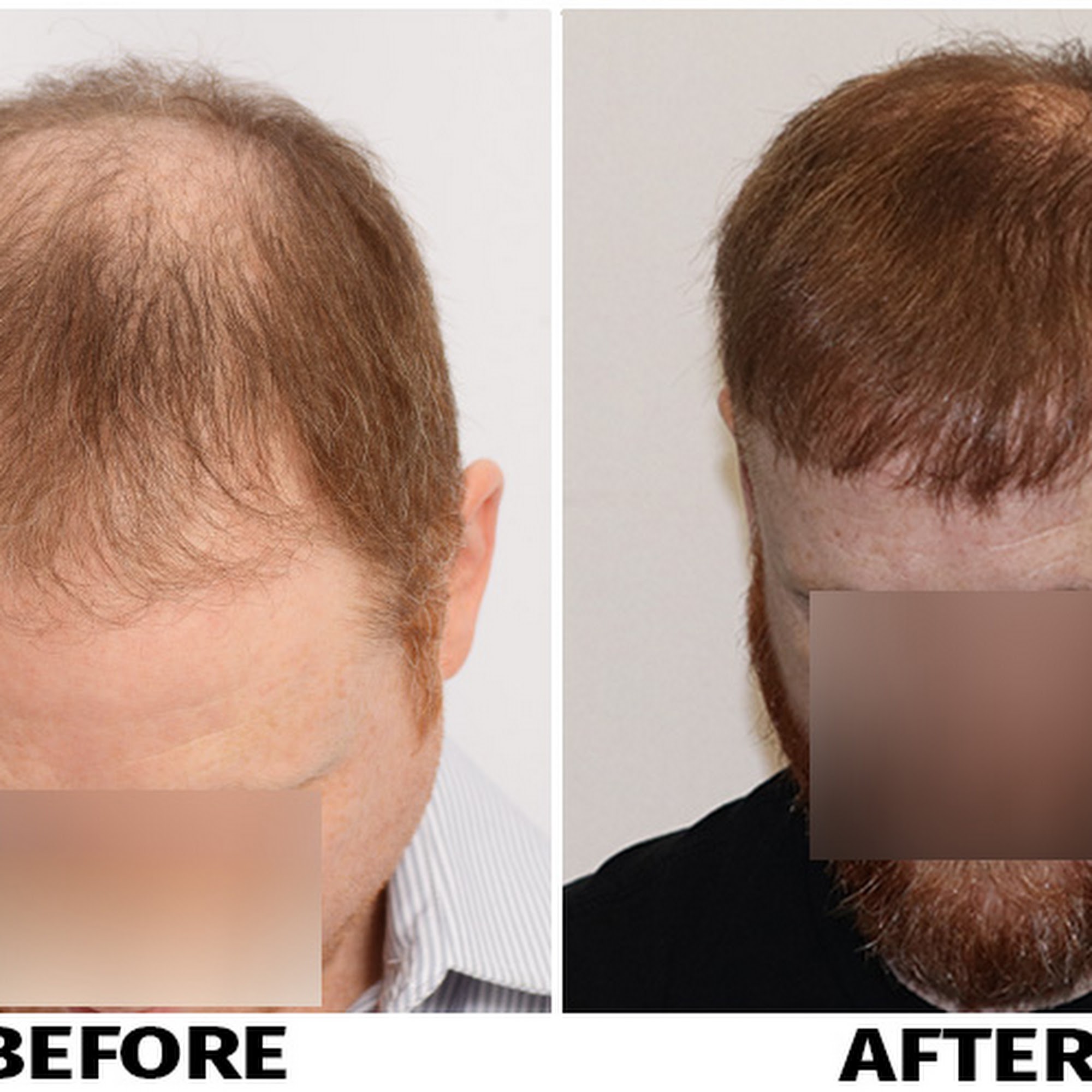ForHair NYC Restoration Clinic - Dr. John Cole