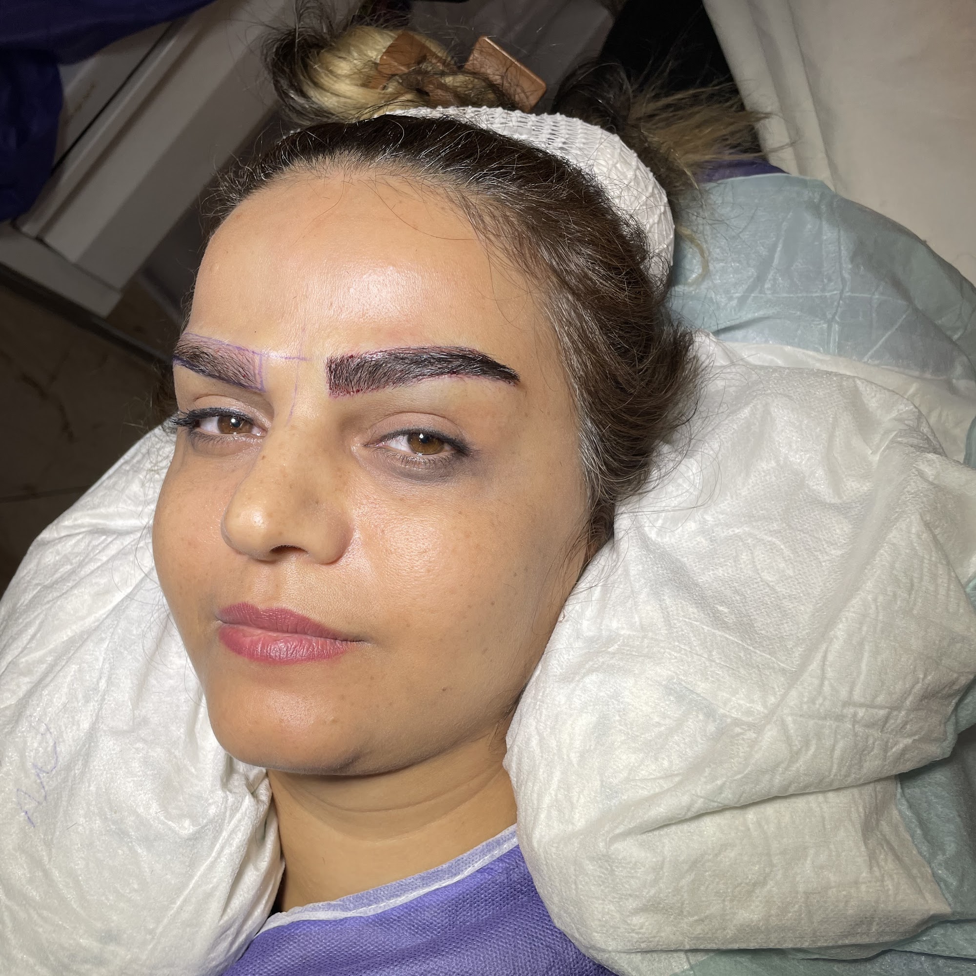 مرکز زیبایی کاشت ابرو و لیزر مو دکتر نیلوفروالی