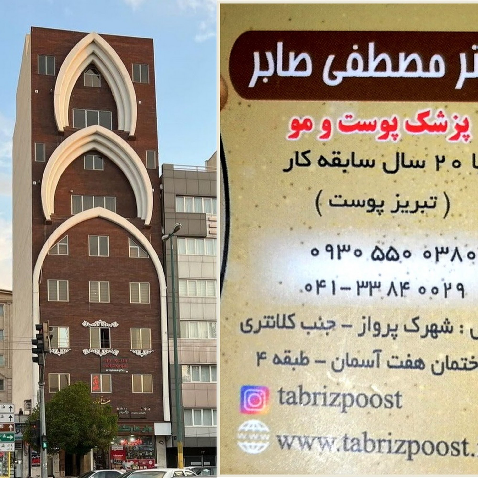 بوتاکس در تبریز