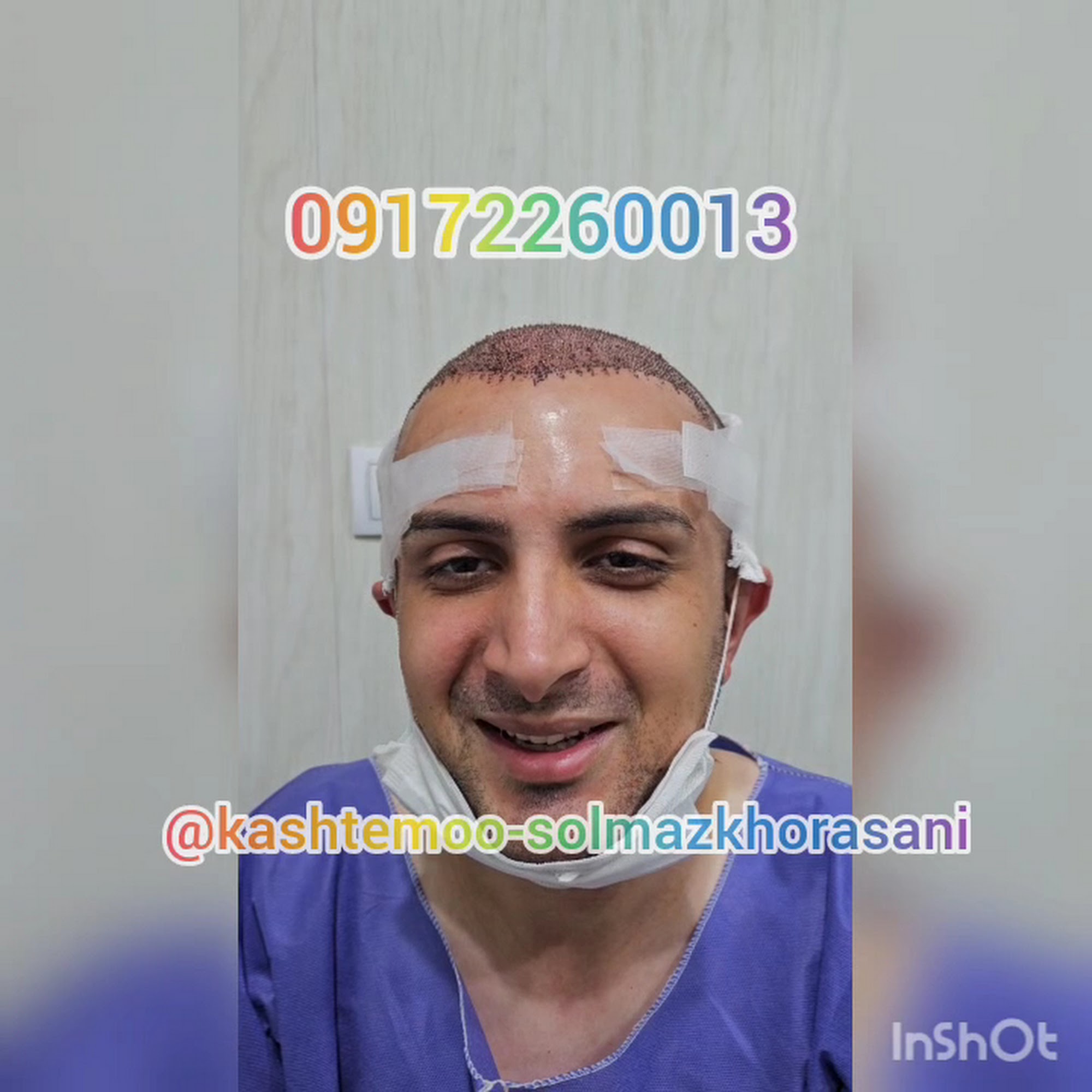 کلینیک کاشت موی طبیعی نیک