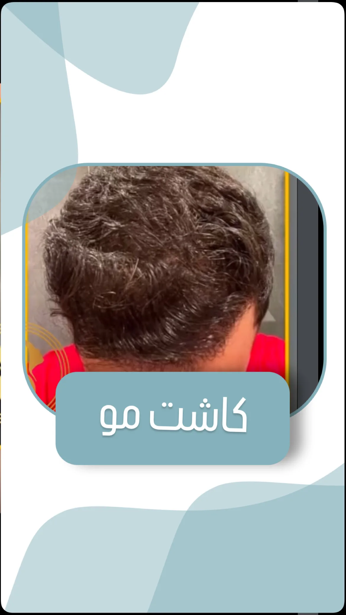 کلینیک زیبایی کاشت مو وابرو ایران مهر