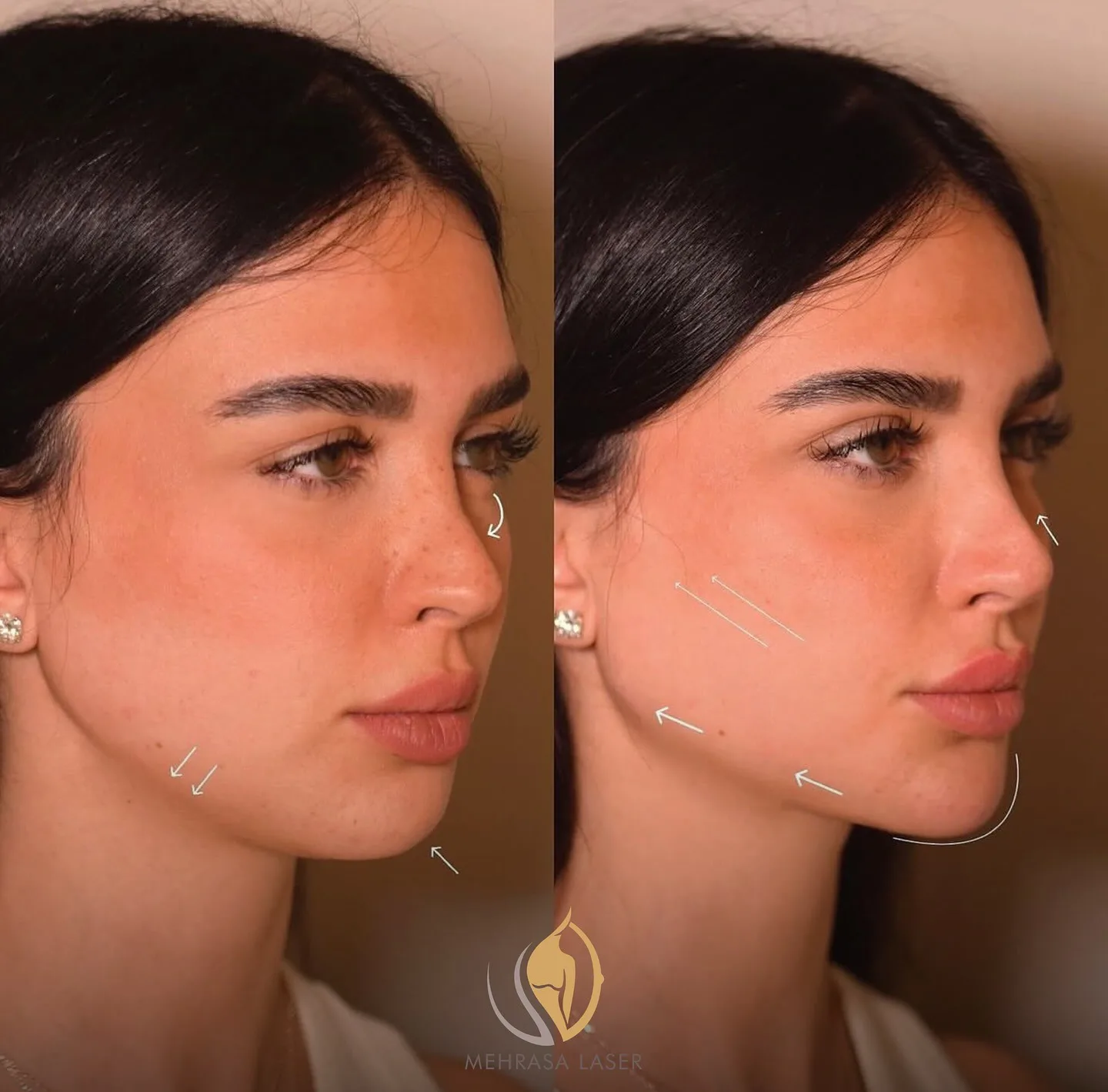 مرکز لیزر مهرآسا