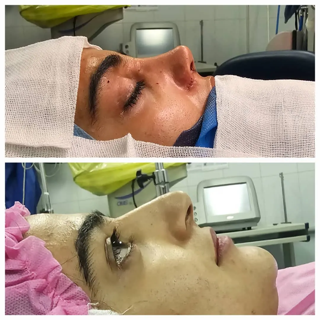 متخصص و جراح /فک و زیبایی صورت/گوش،حلق،زیبایی بینی/پلک