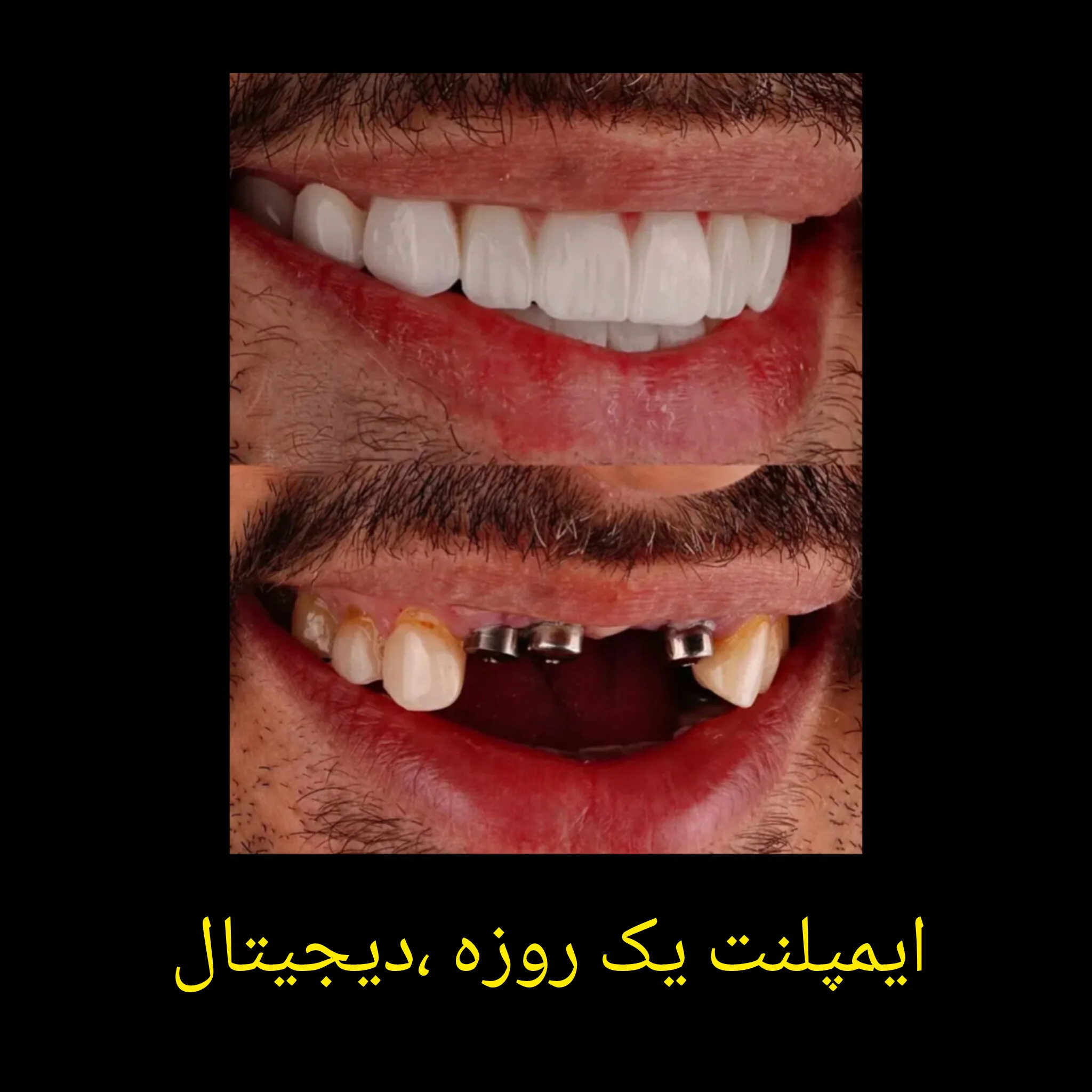 کلینیک ایمپلنت و جراحی فک دکتر جمالی