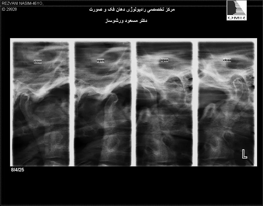 رادیولوژی فک‌ و صورت دکتر مسعود ورشوساز