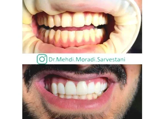 دکتر مهدی مرادی سروستانی