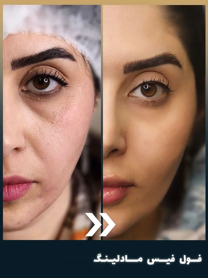 کلینیک زیبایی بنیتا