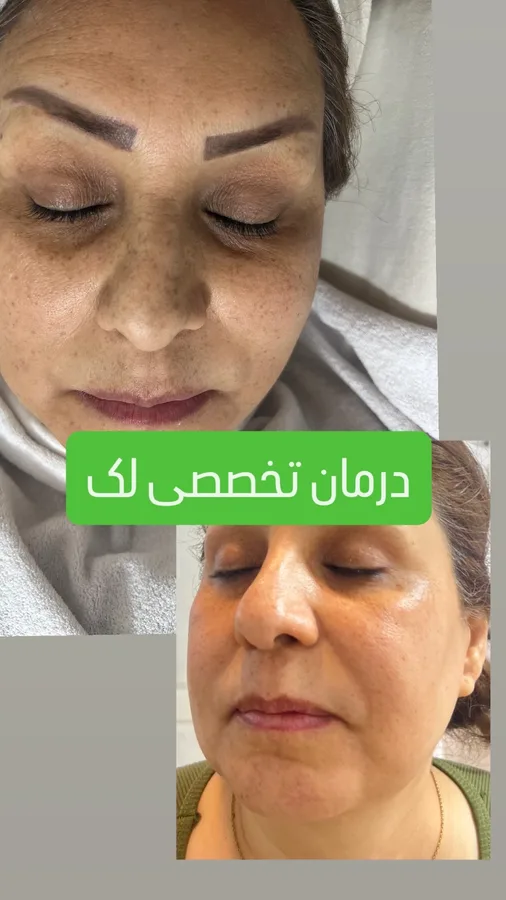 مرکز تخصصی پوست ملیکا
