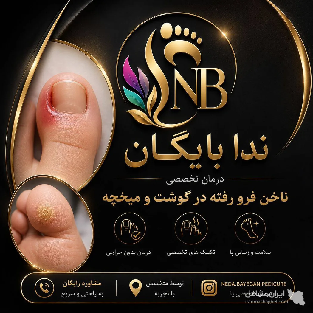 درمان ناخن فرو رفته در گوشت و میخچه ندا بایگان در قزوین