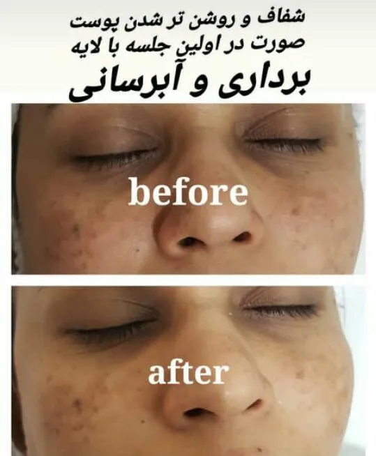 خدمات تخصصی پوست و فیشیال مهدیس در یزد