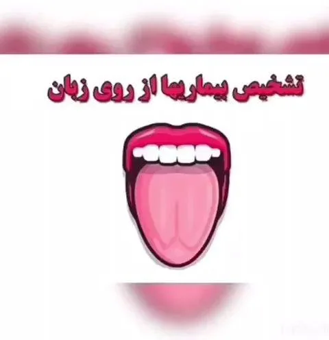طب زبانشناسی حمزه پور