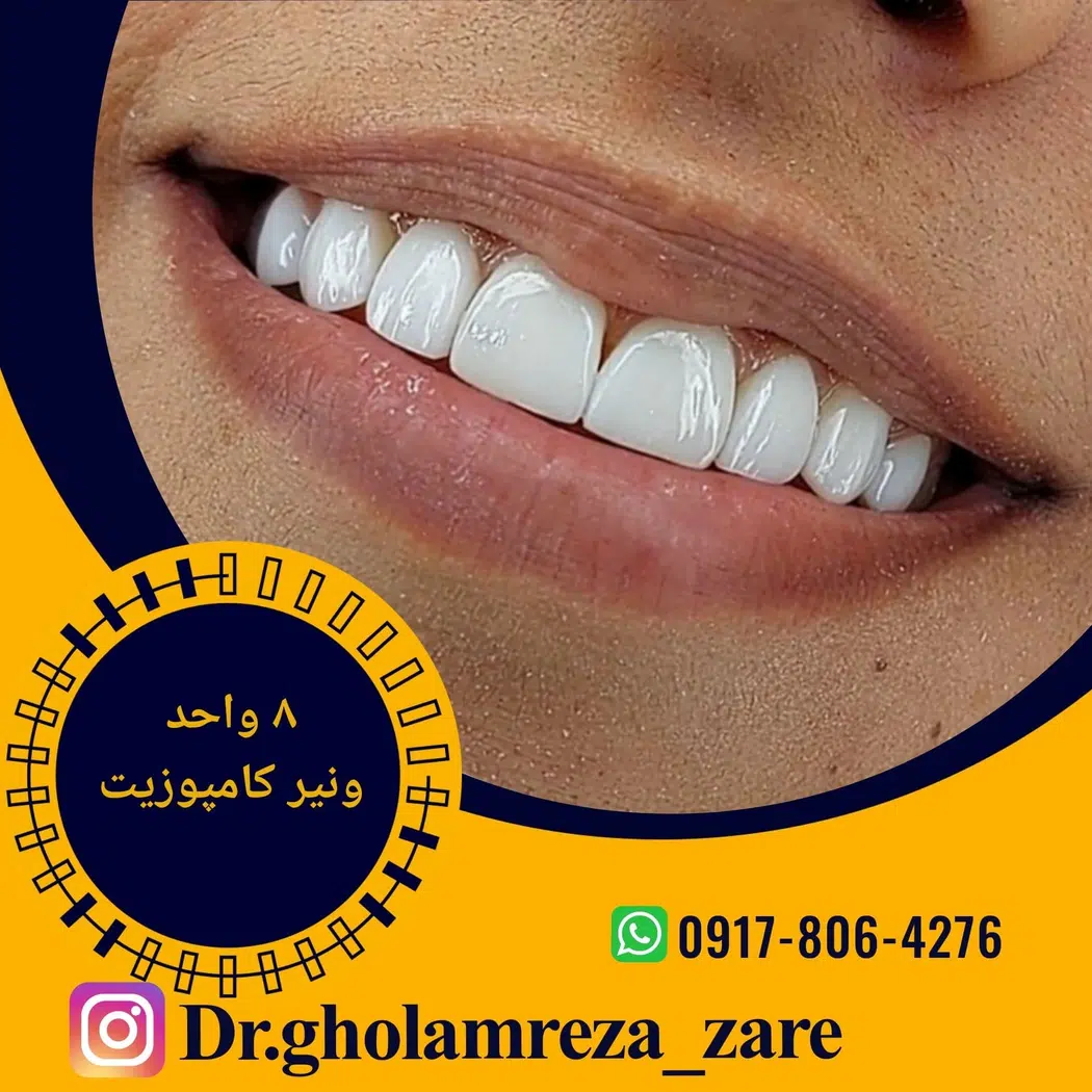دندانپزشکی دکتر غلامرضا زارع