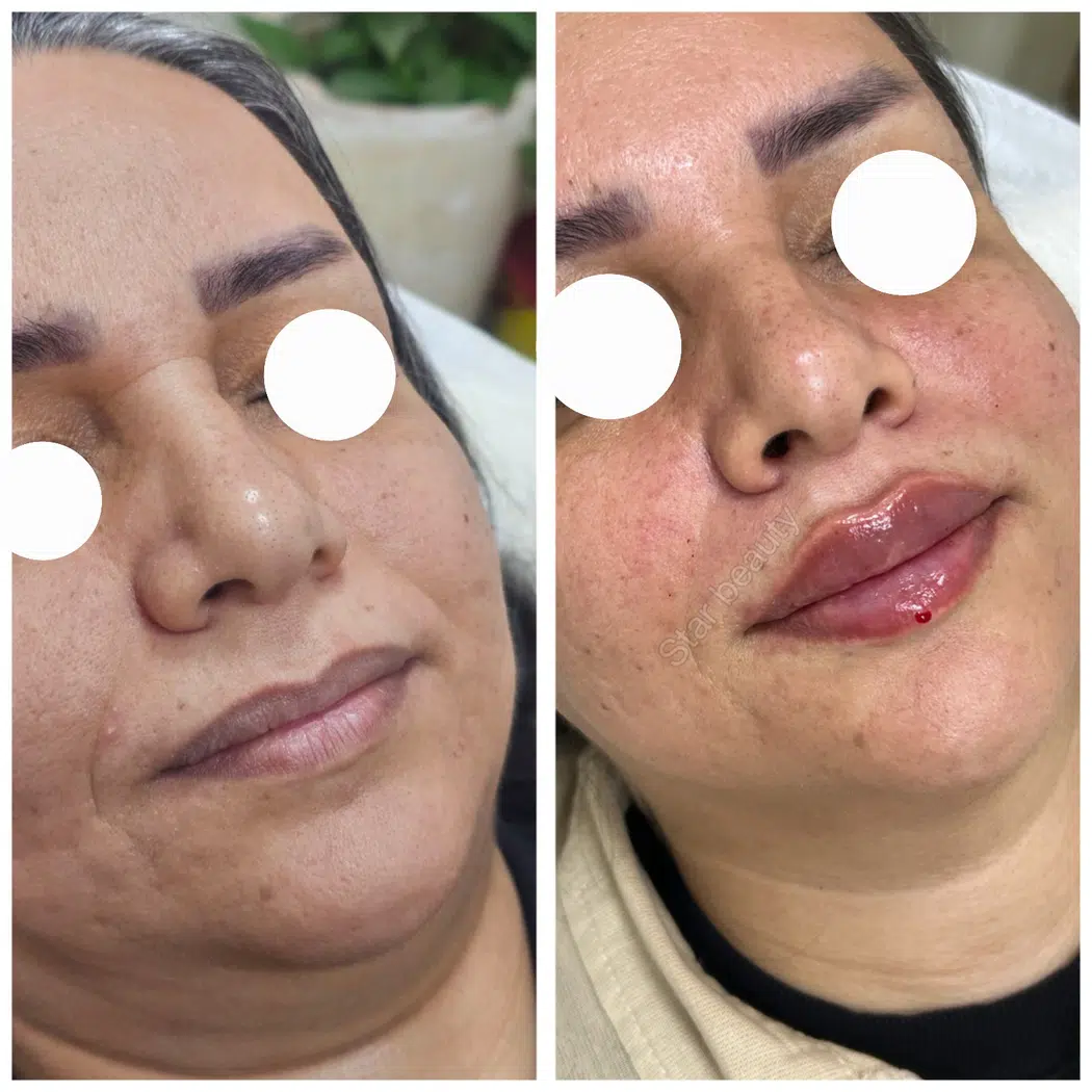 مطب زیبایی دکترمهسا رحیمی
