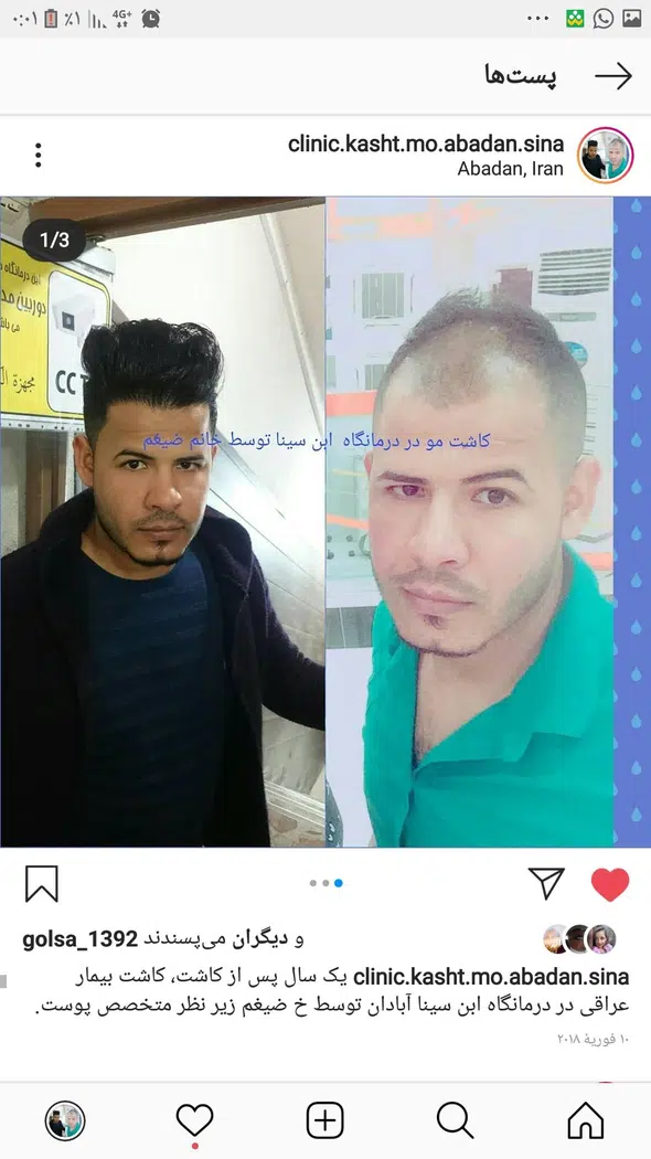کلینیک تخصصی پوست و کاشت مو ابن سینا