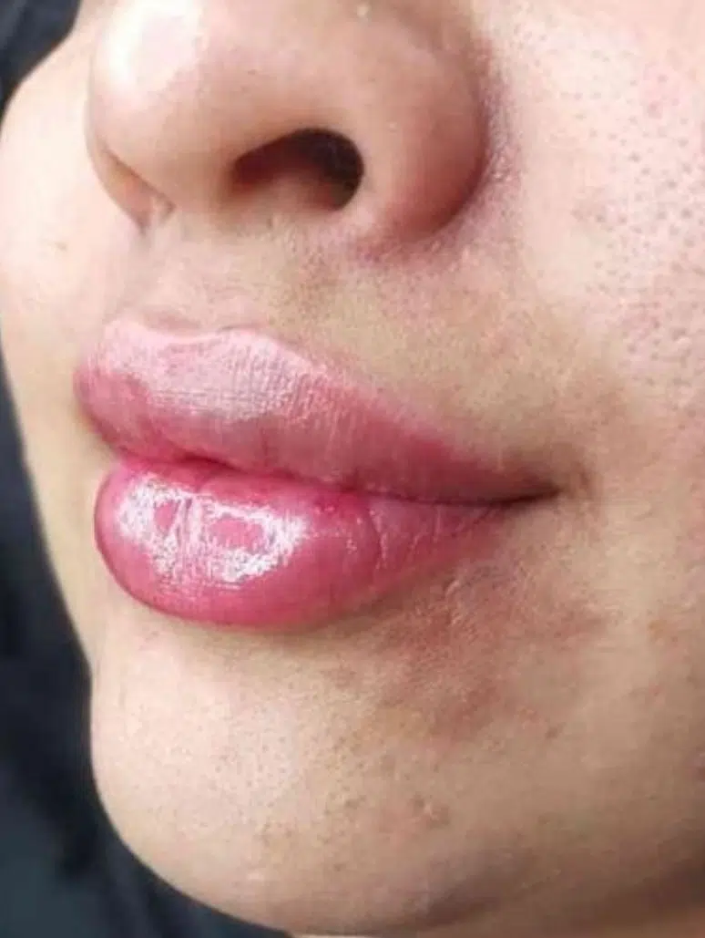 کلینیک زیبایی آیلین