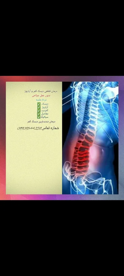 درمان دیسک
