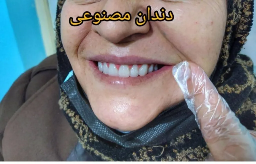 لابراتوار پروتز دندانسازی احمدی در تبریز