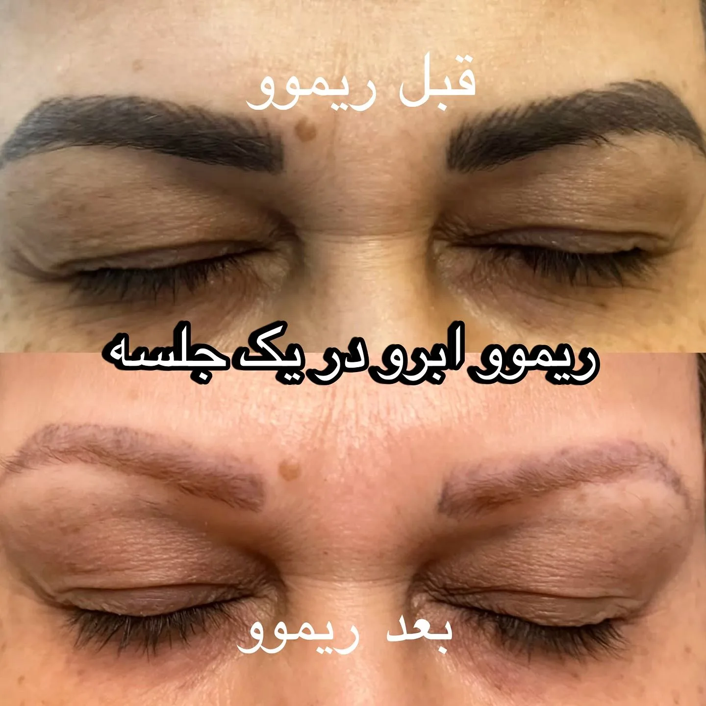 متخصص ریمو ابرو نگار قاسمی
