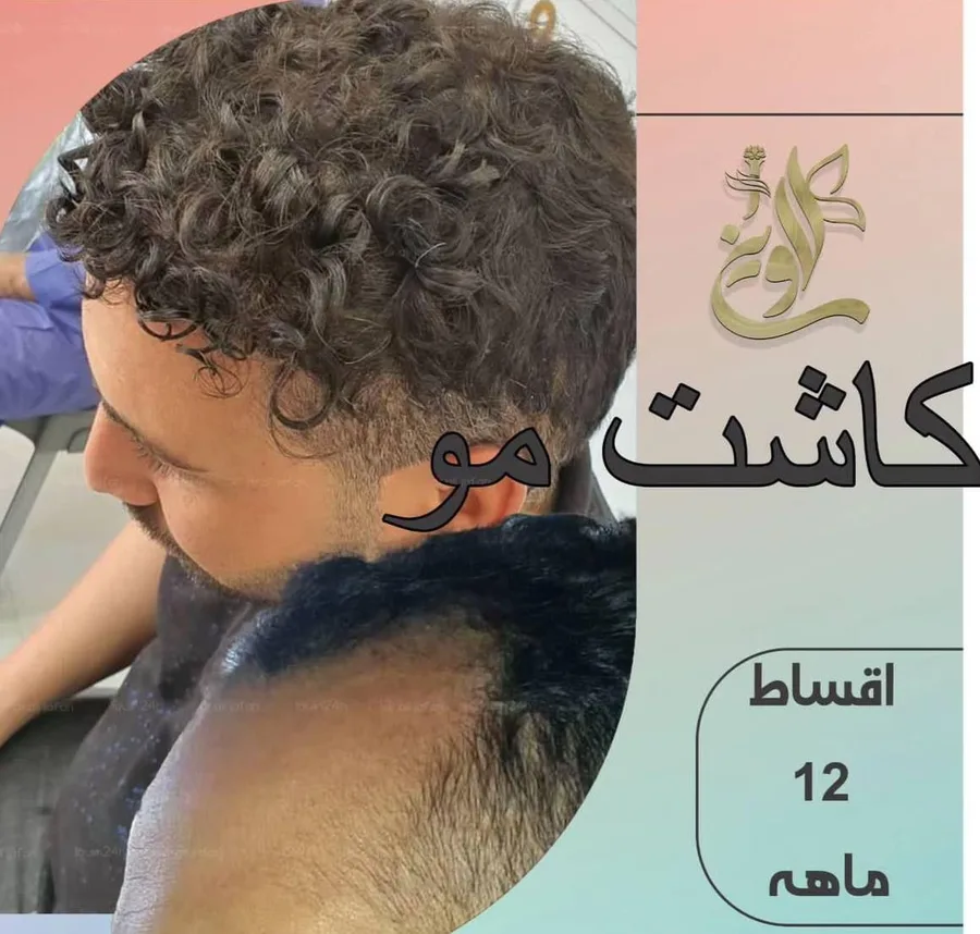 کلینیک کاشت مو و ابروی لاوین